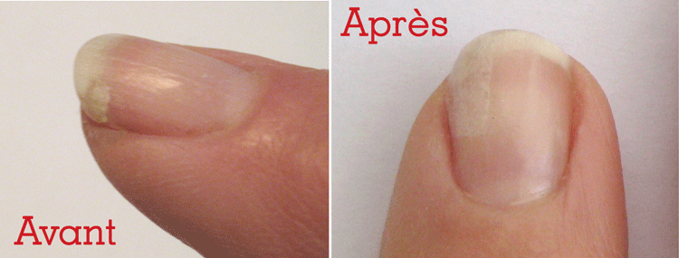 Relooking easy: Réparer un ongle cassé Relooking easy: Réparer un ongle cassé