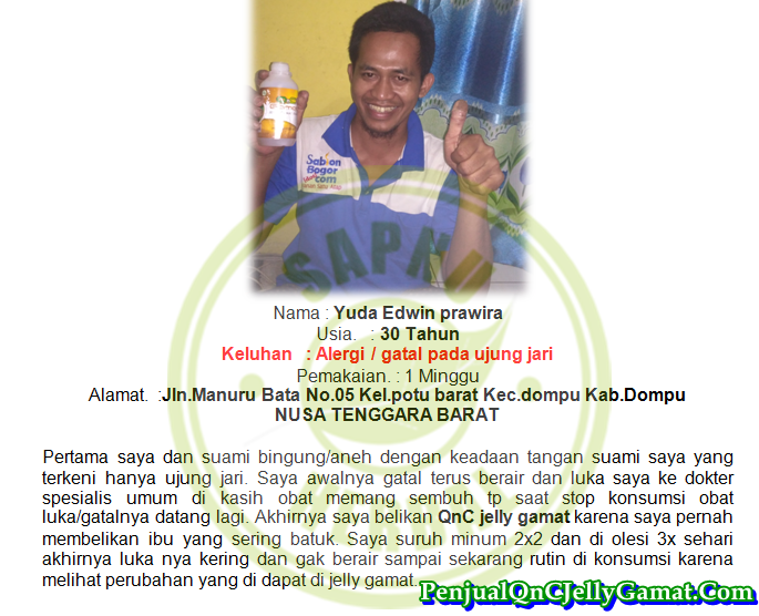 Cara Ampuh Mengobati Impetigo Secara Total Cara Ampuh Mengobati Impetigo Secara Total