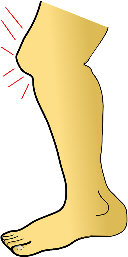 Dibujo de dolor de rodilla