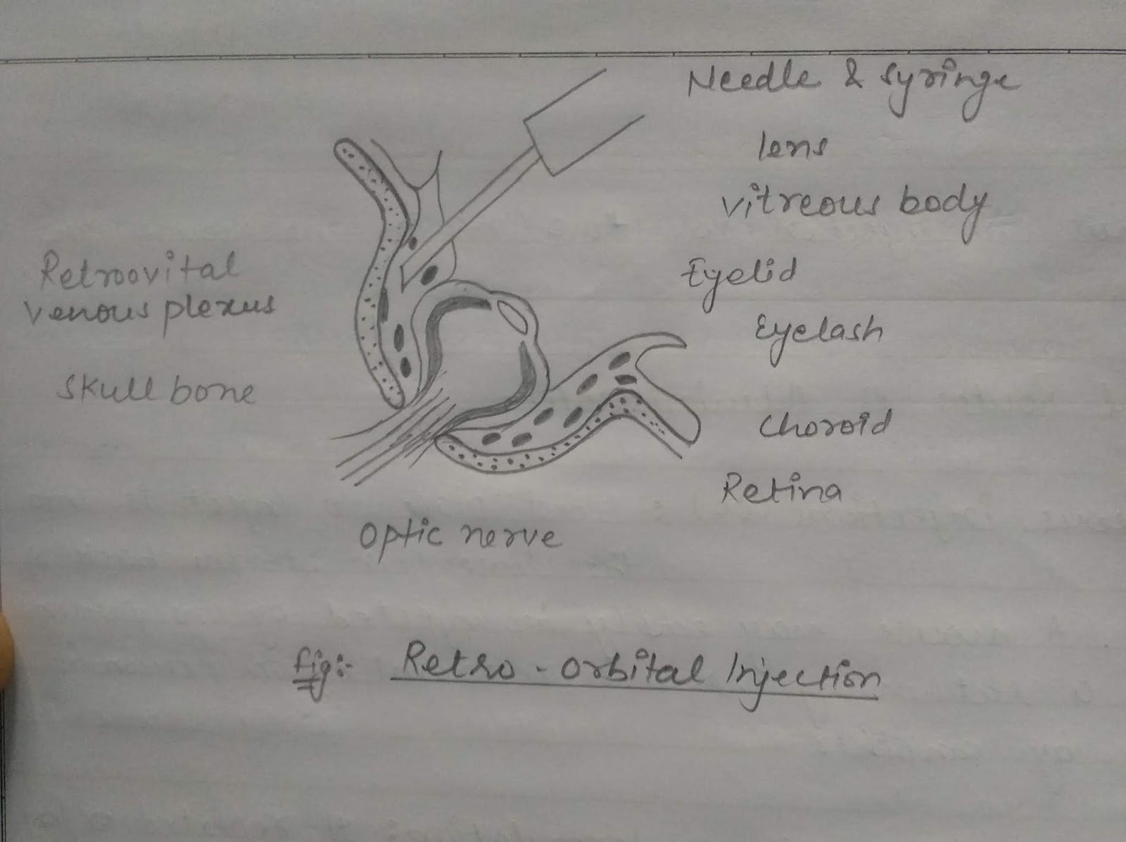 Retro orbital injection diagram