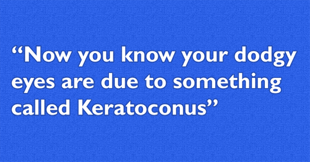 Now you know your dodgy eyes are due to something called Keratoconus
