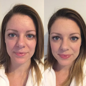 BareMinerals blemish remedy foundation review before and after photo