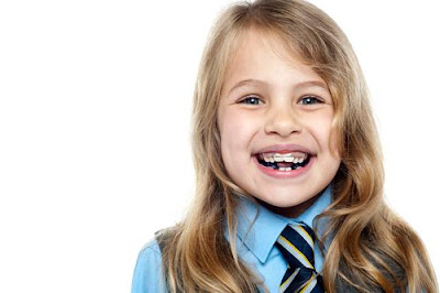 Giá niềng răng mọc lệch ở trẻ em
