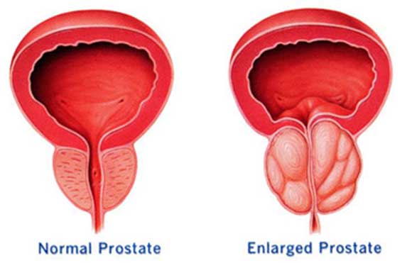 prostata en animales