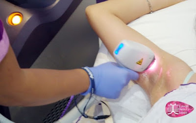 Laser treatment has become a popular solution for hair removal purposes. Lasers are popular because of their effectiveness as well as pain-free procedures. While most people can do laser hair removal, some of the following are not the right candidates for laser hair removal. But there are some side effects from this treatment