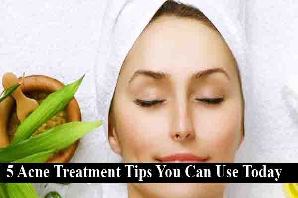 acne control tips