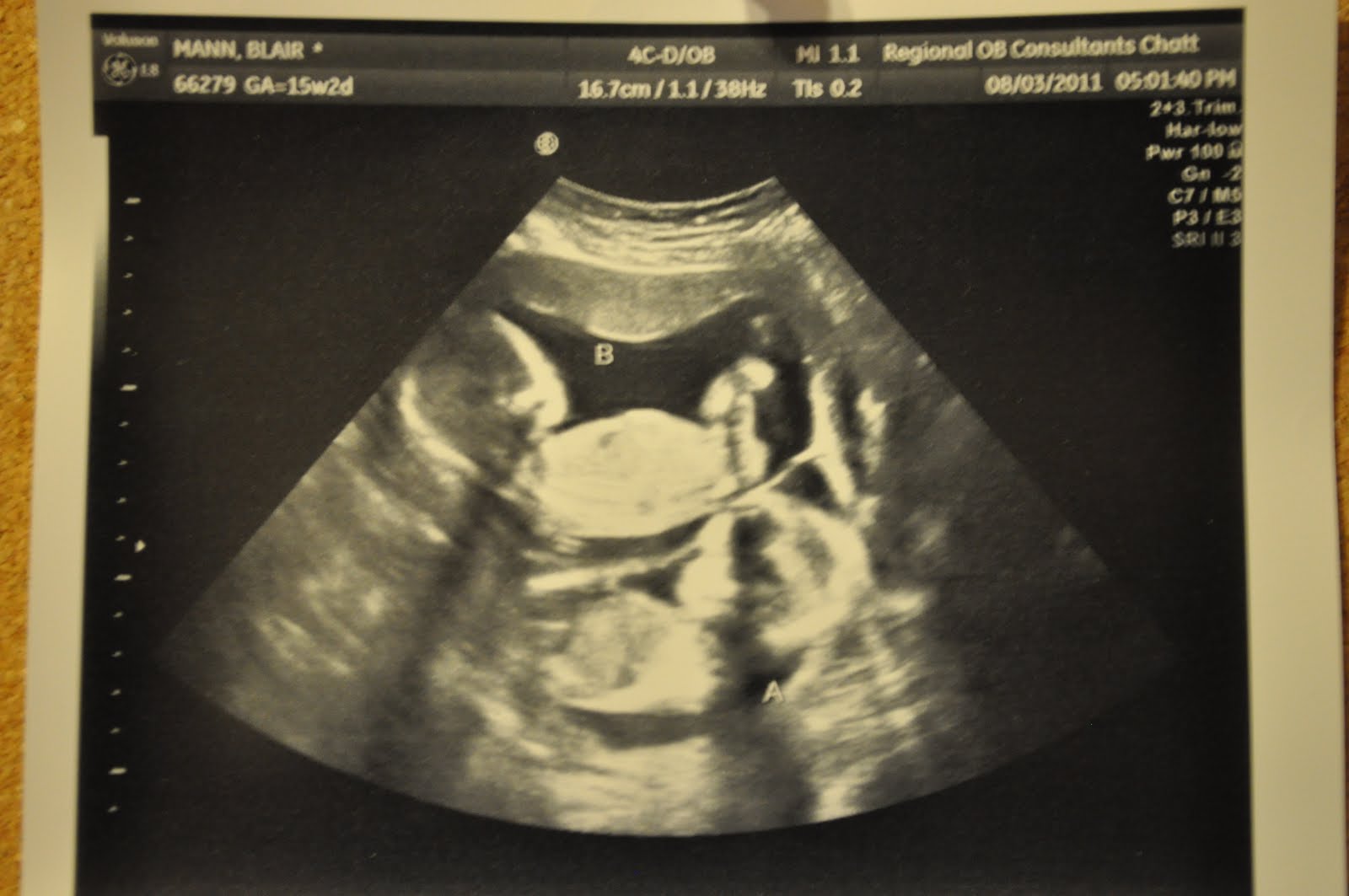 4d ultrasound at 15 weeks