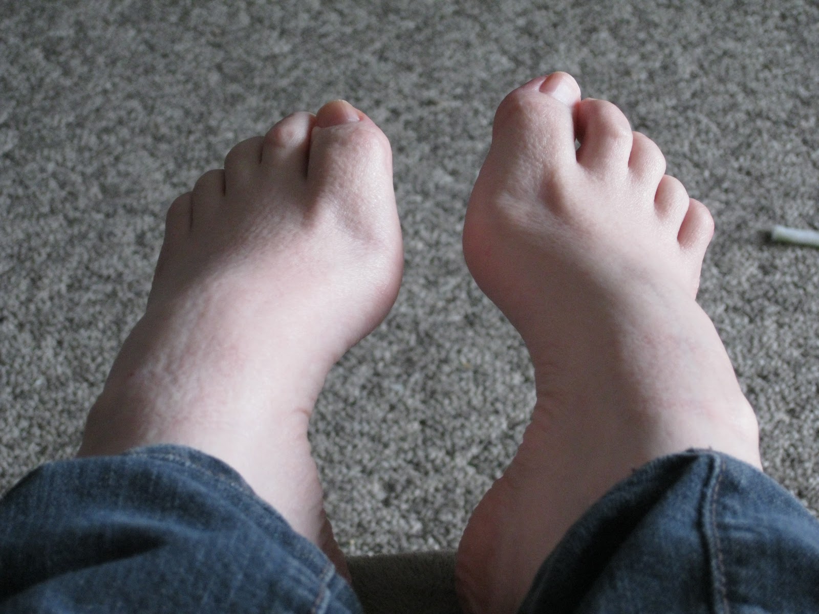 Wide foot