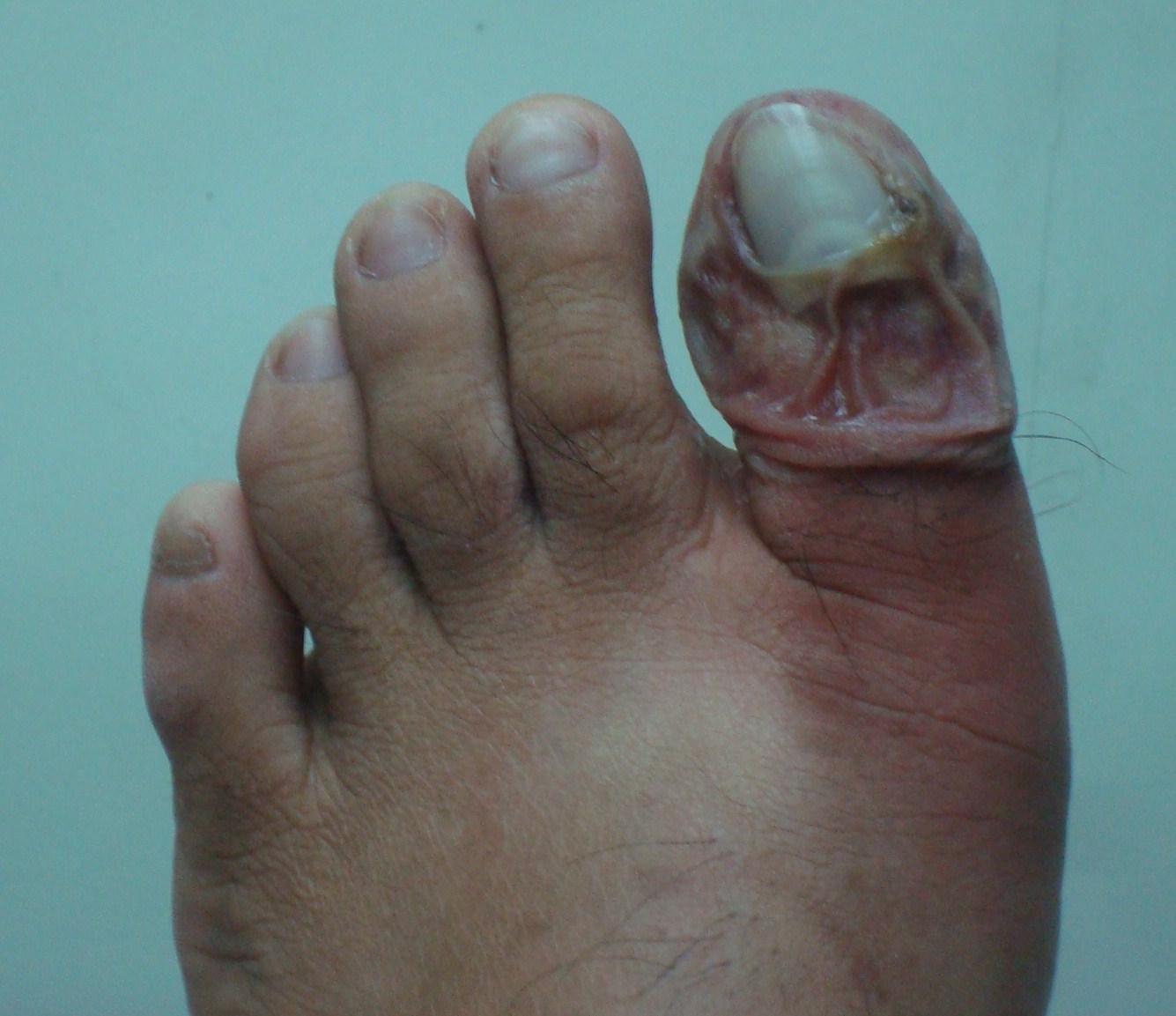 My Dog S Foot Is Swollen My Dog S Foot Is Swollen