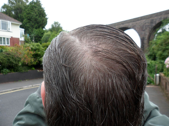 There is a bald spot!