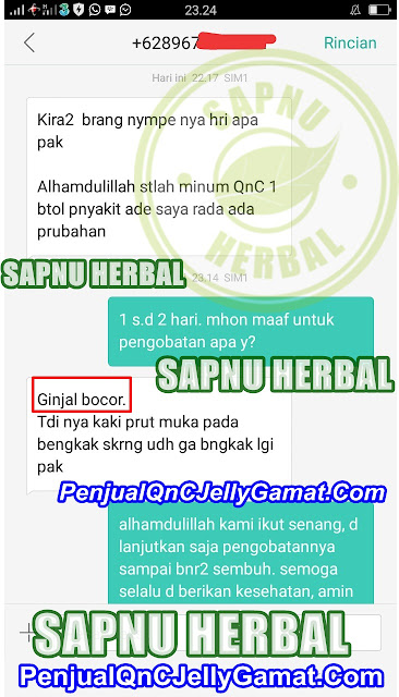 Cara Ampuh Menyembuhkan Ginjal Bengkak Sebelah Kanan dan Kiri Secara Alami Cara Ampuh Menyembuhkan Ginjal Bengkak Sebelah Kanan dan Kiri Secara Alami