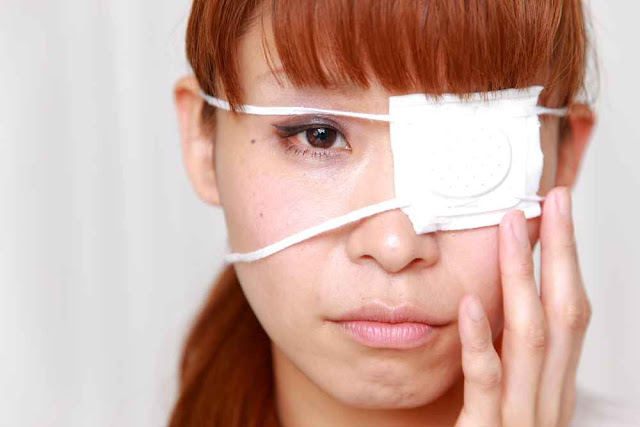 Cara Menghilangkan Xanthelasma / Endapan Lemak Di Kelopak Mata
