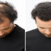 THE MAGIC HOMEMADE RECIPE FOR FASTEST HAIR GROWTH! 3 INGREDIENTS ONLY