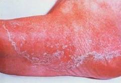 Dermatologi Jenis jenis penyakit kulit