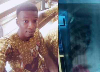 Photos: "Only fools says there is no God" - Bullet hits young Nigerian man sleeping inside his home, narrowly missing the heart
