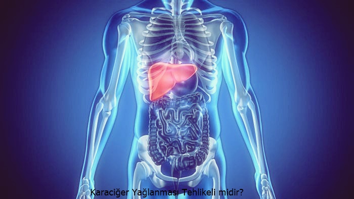 Hepatomegali - nedir ve nasıl ortaya çıkıyor Hepatomegali - nedir ve nasıl ortaya çıkıyor
