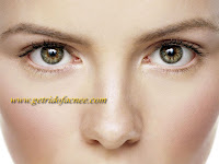 Acne No More Full Ebook