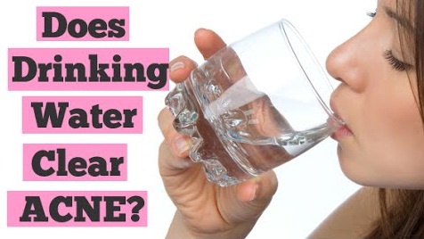 does drinking alot of water help acne does drinking alot of water help acne