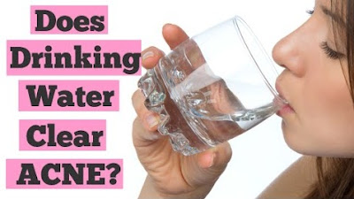 acne water drinking help does go away
