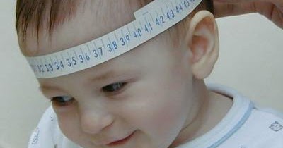 Маленькая окружность головы. Микроцефалия окружность головы. Микроцефалия антропометрия. Измерение головы ребенка. Измерение окружности головы у детей.