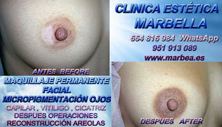 micropigmentación de la areola Mastectomia Tratamiento cicatrices pechos