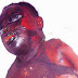 Final Year Student Bathed With Acid By Motorcysclists In Maiduguri