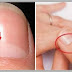Do you know what the half-moon shape on your nails means? The answer is more important than you think…