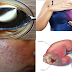 Cure Different Diseases by Consuming Apple Cider Vinegar, Garlic and Honey Mixture