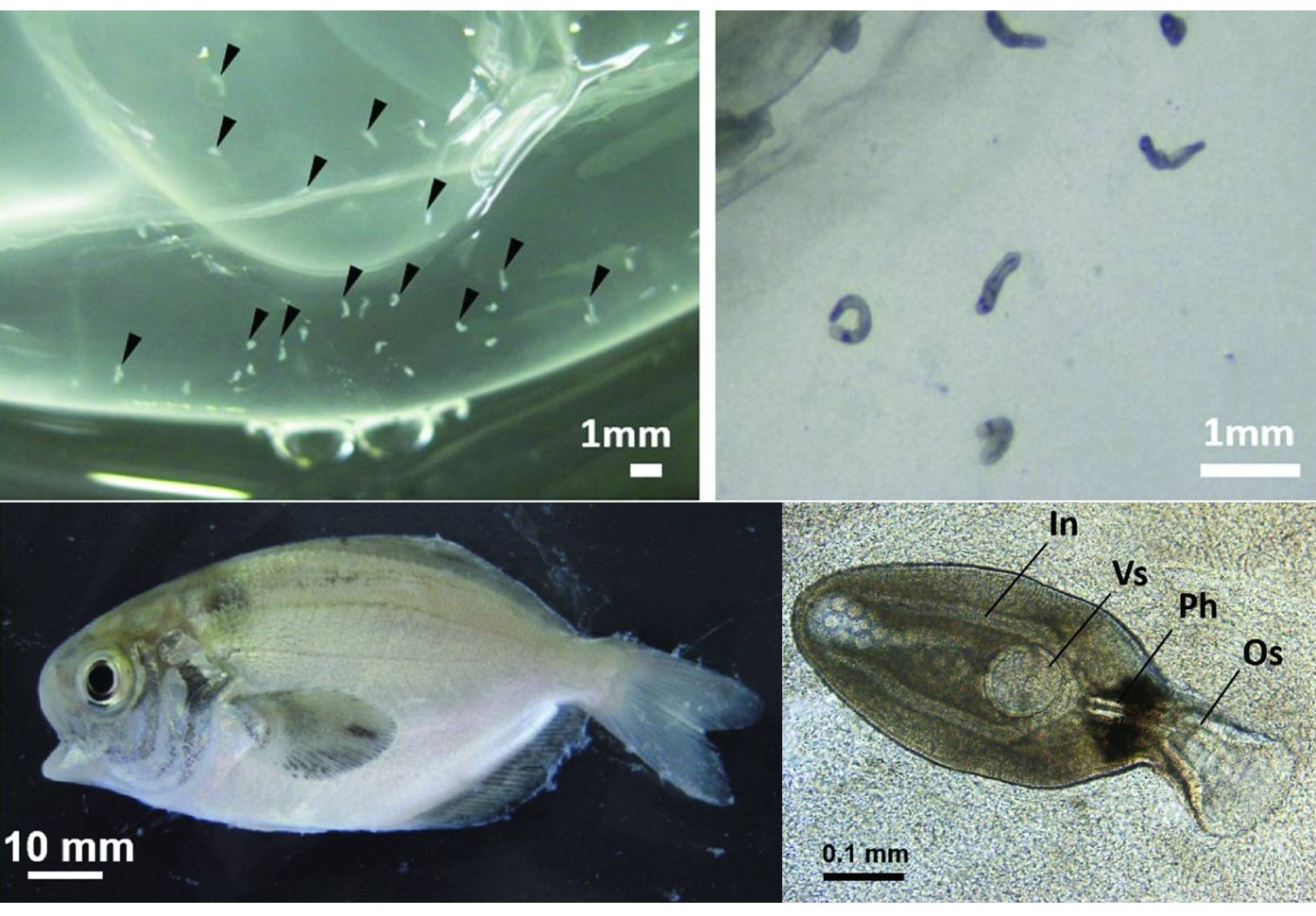 Parasite of the Day Opechona olssoni