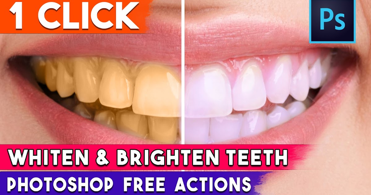 Free Download 1 Click Whiten Teeth Magic Actions