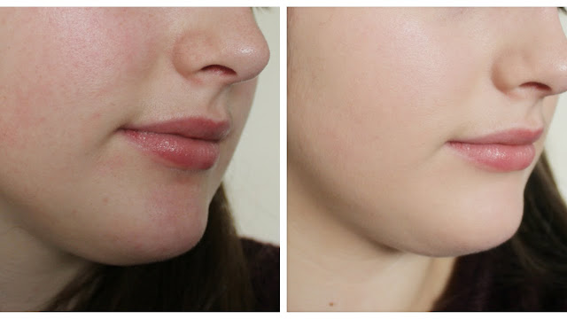 3 Best Skin Care Tips - Natural Ways To Get The Perfect Skin 3 Best Skin Care Tips - Natural Ways To Get The Perfect Skin