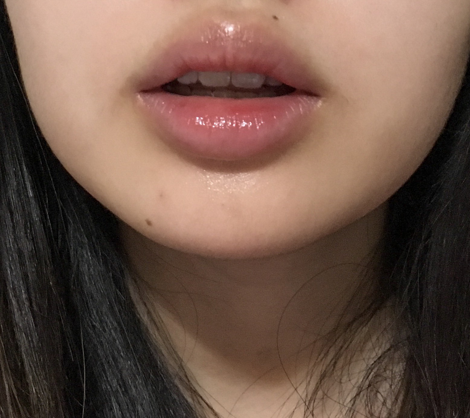Dry Lip Care Routine for Cold Weather Imagette