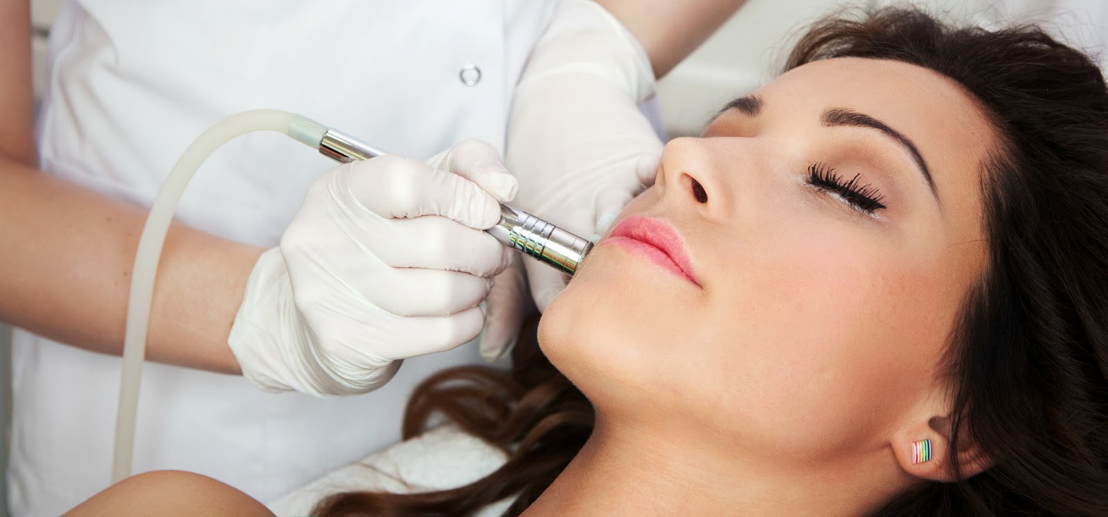 Visage Skin Clinic Microdermabrasion for Acne Scars Treatment in Pune