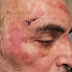 Torinese aggredito dal branco: «Brutto ricch**ne ti ammazziamo»