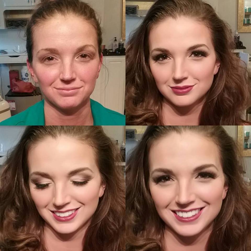 2017 Before And Afters Onsite Muse Hmua