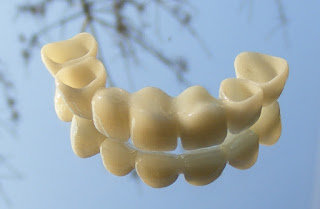 Zirkonyum Diş kaplama Resim Diş Dr Sertaç Kızılkaya