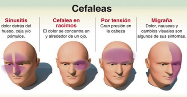 Los ejercicios para sheyno del departamento dorsal