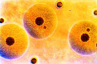 Resultado de imagen de la celula mas pequeÃ±a bacteria