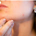 Apply This 4 Tips And All Your Skin Pores Will Disappear.