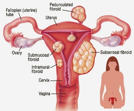 Vaginal Atresia: Background, Anatomy, Pathophysiology