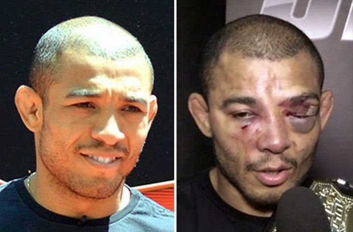 Ufc Fighters Before And After A Fight ~ Damn Cool Pictures