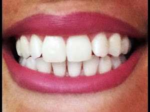 Dents blanches: Voici comment fabriquer son dentifrice bio en 1 min ! Sans FLUOR, sans produits CHIMIQUES