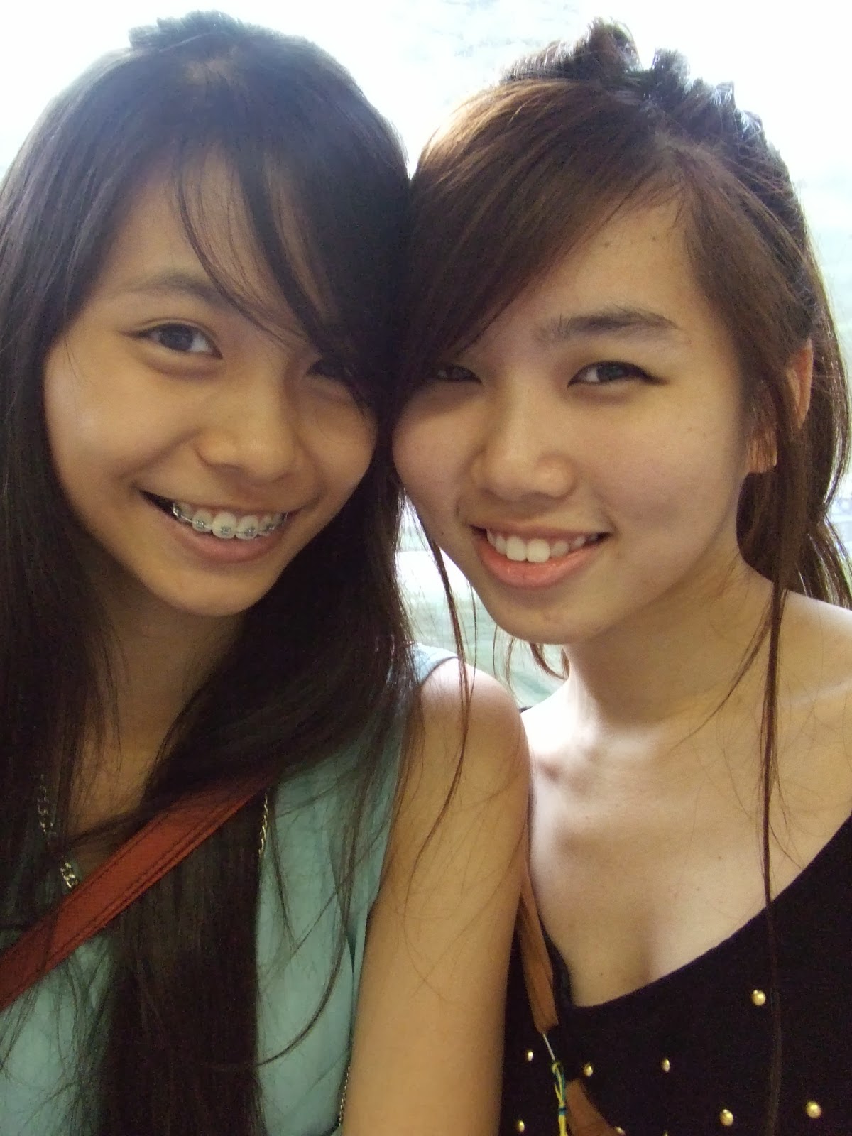My Braces Journey XINLIN Singapore Travel, Lifestyle and Beauty blog