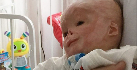L’infirmière met ce bébé dans son berceau. Quand elle voit son visage quelques minutes plus tard, elle hurle d’horreur.