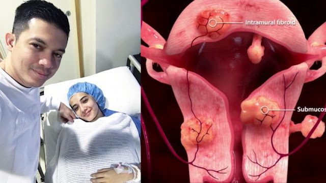 Mengungkap Endometriosis dan Fibroid yang Menyerang Zaskia Sungkar