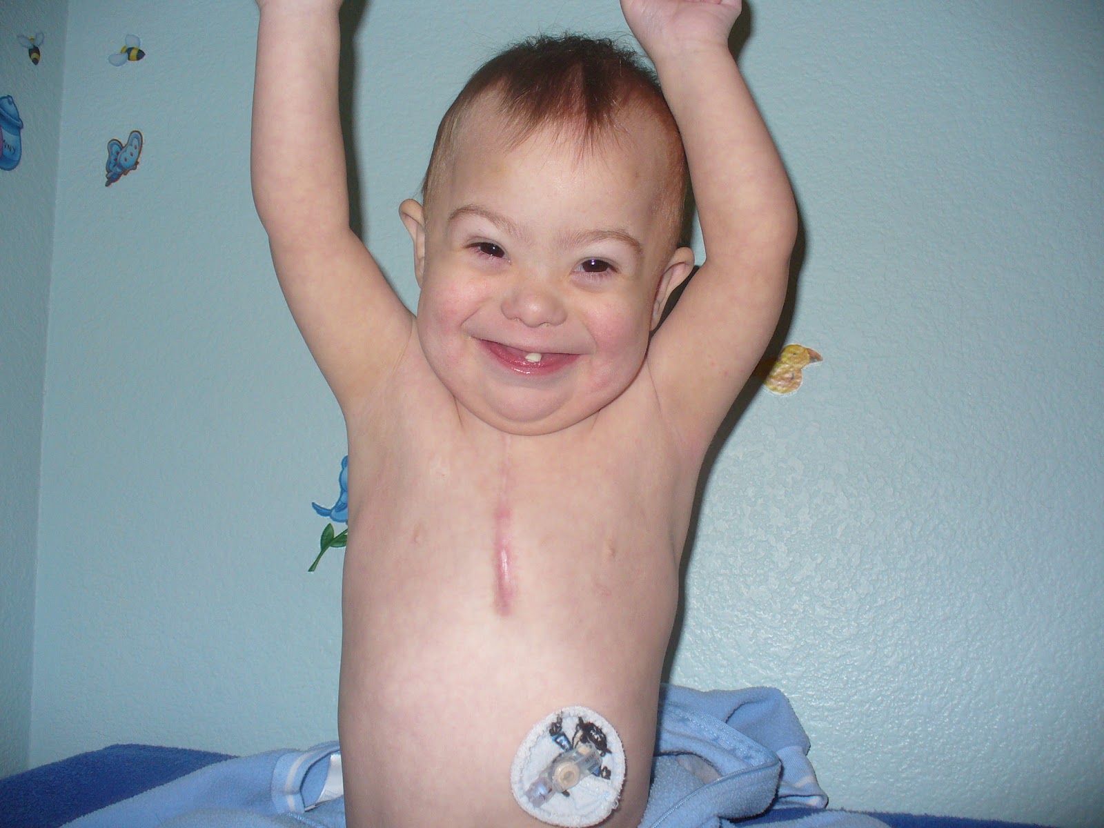 Team David Feeding Tube Awareness Week Begins