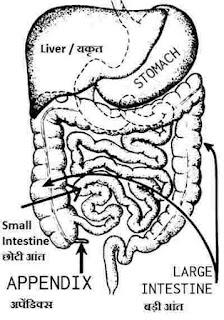 Appendicitis-symptoms-causes-treatment-in-hindi