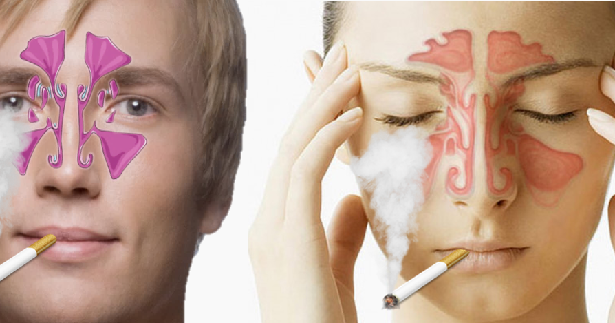 Hpv naso sintomi. Tratamento papiloma humano, Hpv naso sintomi