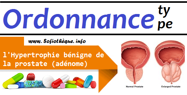 Médicaments pour comprimés de prostatite, exercices de relaxation de la prostatite