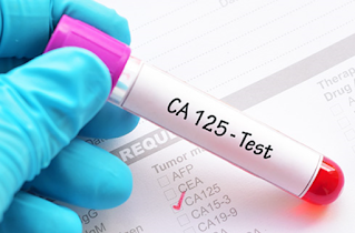 تحليل الواسمة الورمية  CA 125